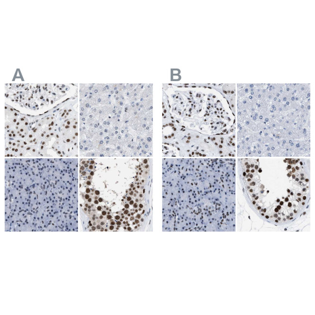 DBC1 Antibody in Immunohistochemistry (IHC)