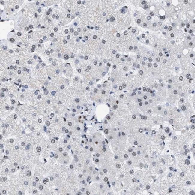 DBC1 Antibody in Immunohistochemistry (IHC)