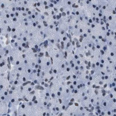 DBC1 Antibody in Immunohistochemistry (IHC)