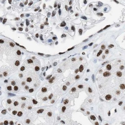 DBC1 Antibody in Immunohistochemistry (IHC)