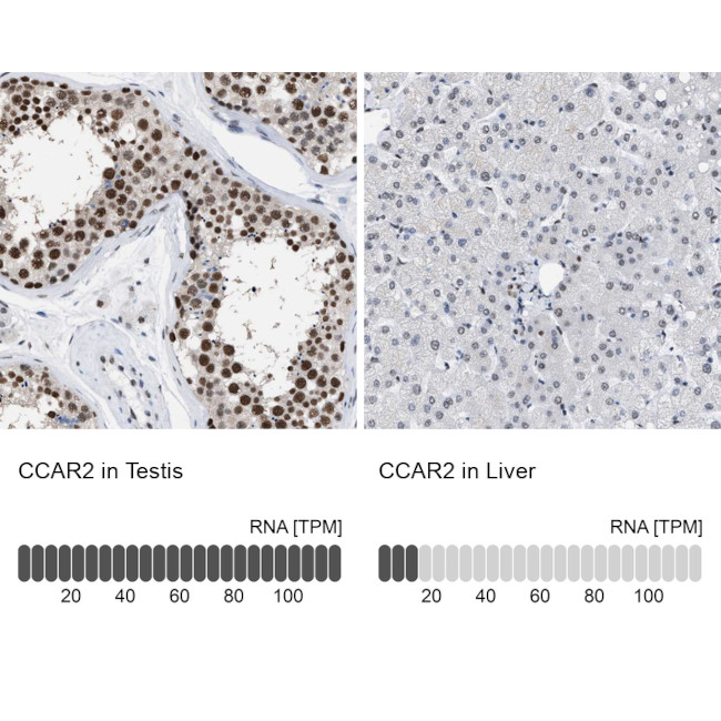 DBC1 Antibody