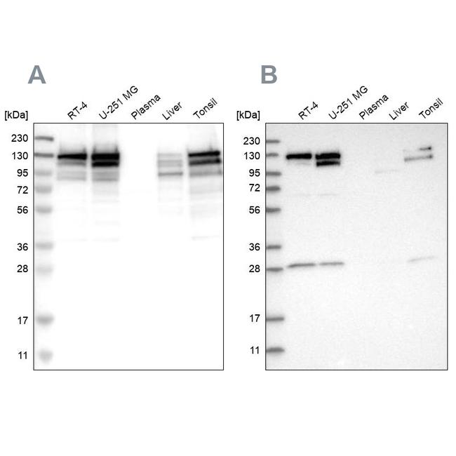 DBC1 Antibody in Western Blot (WB)