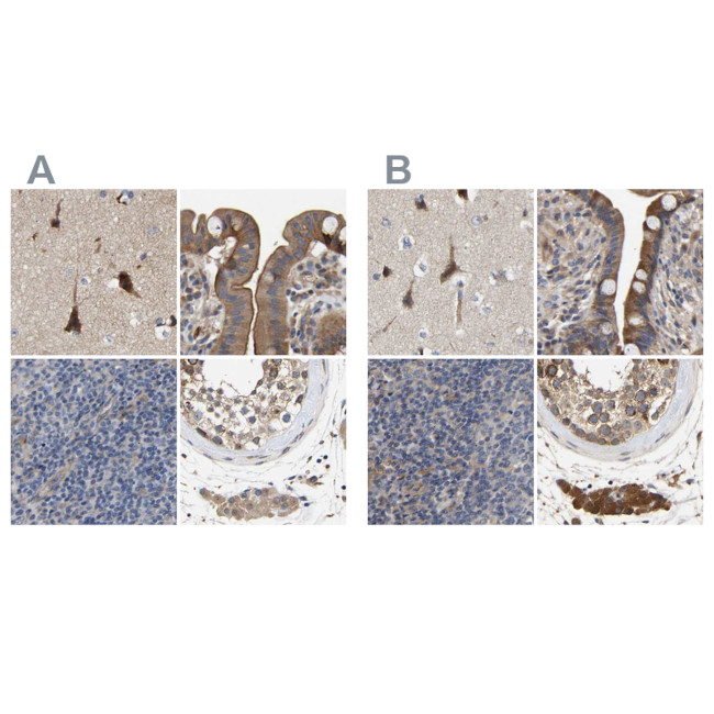 CCDC155 Antibody in Immunohistochemistry (IHC)