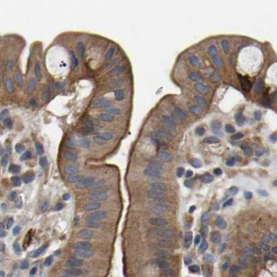 CCDC155 Antibody in Immunohistochemistry (IHC)