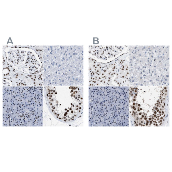 DBC1 Antibody in Immunohistochemistry (IHC)