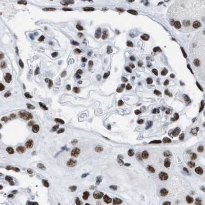 DBC1 Antibody in Immunohistochemistry (IHC)