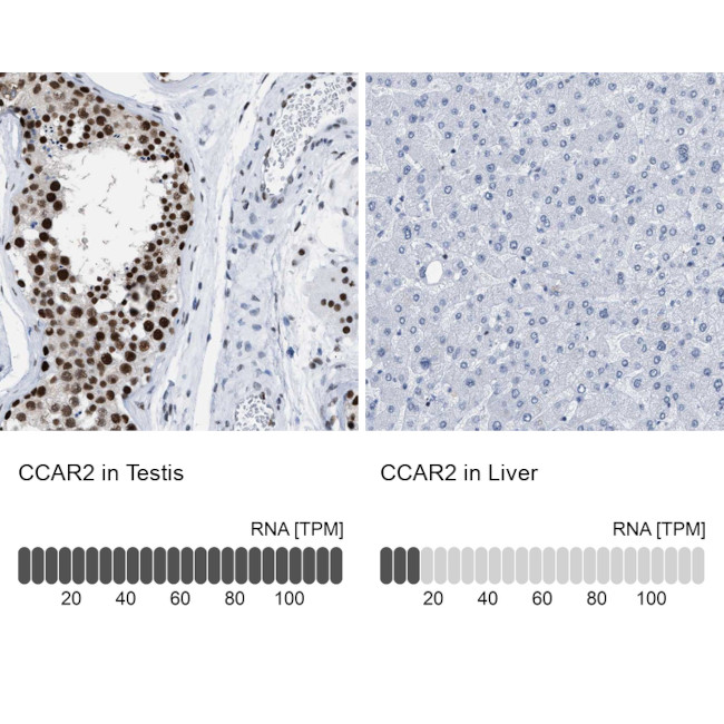 DBC1 Antibody