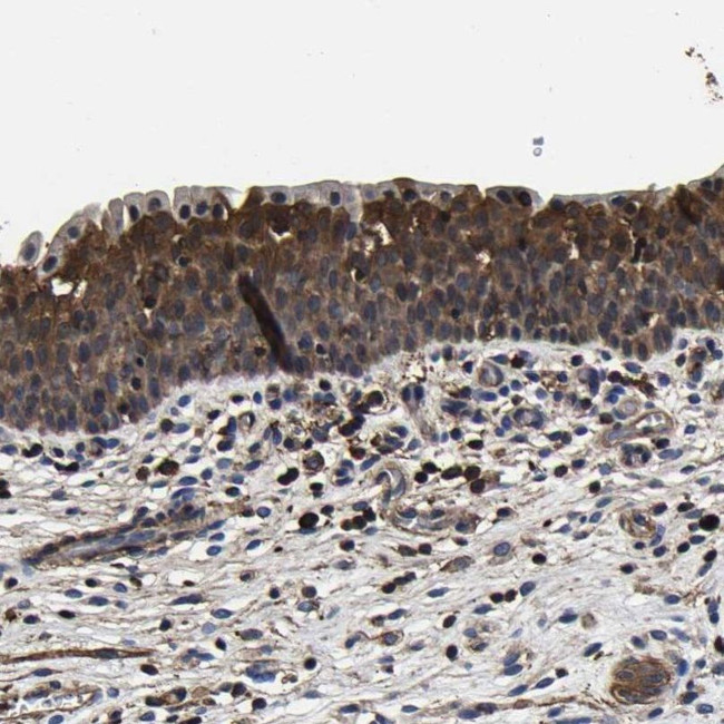 SSH3 Antibody in Immunohistochemistry (IHC)