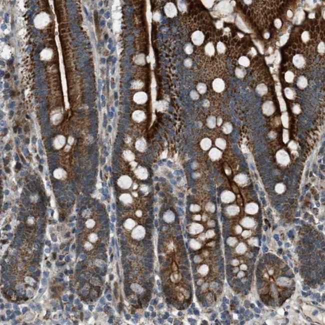 VPS41 Antibody in Immunohistochemistry (IHC)