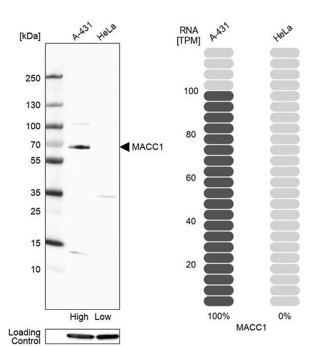 MACC1 Antibody in Western Blot (WB)