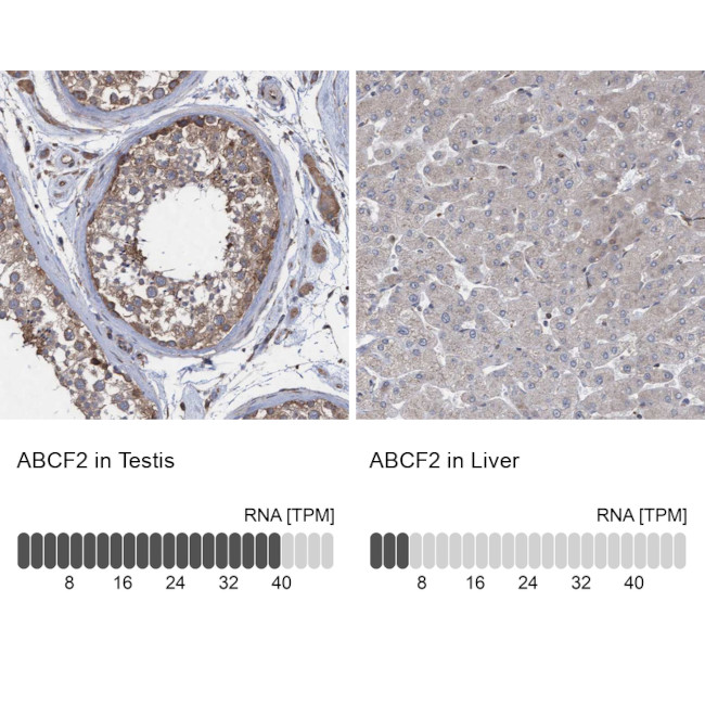 ABCF2 Antibody in Immunohistochemistry (IHC)