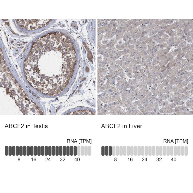 ABCF2 Antibody