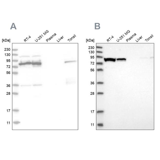 ABCF2 Antibody in Western Blot (WB)