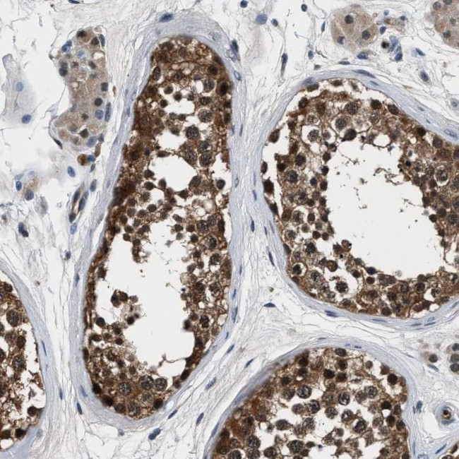 PPA1 Antibody in Immunohistochemistry (IHC)