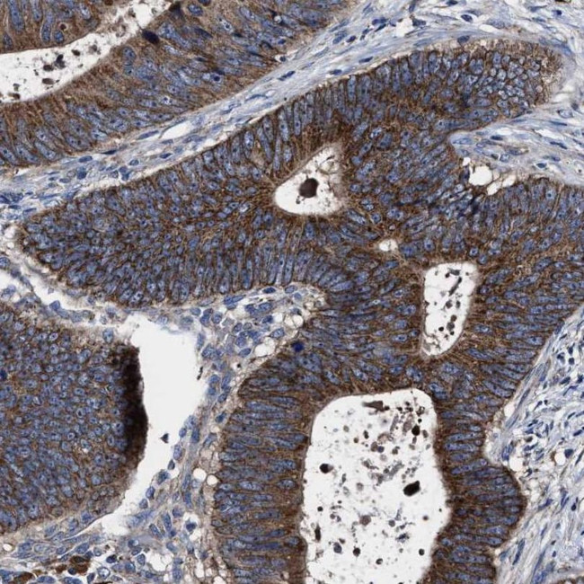 MACC1 Antibody in Immunohistochemistry (IHC)