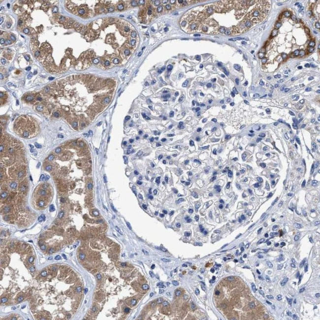 MACC1 Antibody in Immunohistochemistry (IHC)