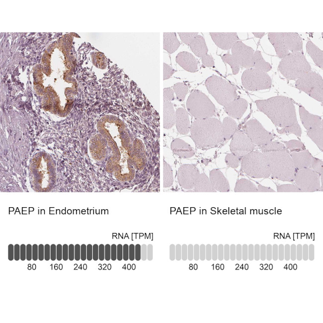 PAEP Antibody in Immunohistochemistry (IHC)