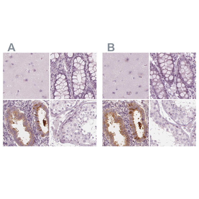 PAEP Antibody in Immunohistochemistry (IHC)