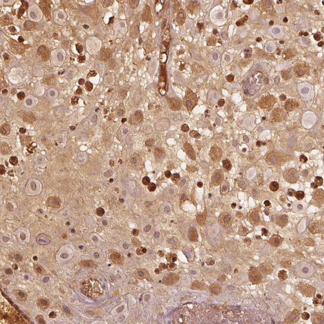 PAEP Antibody in Immunohistochemistry (IHC)