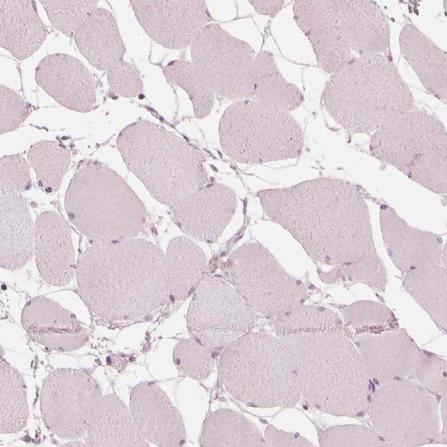 PAEP Antibody in Immunohistochemistry (IHC)