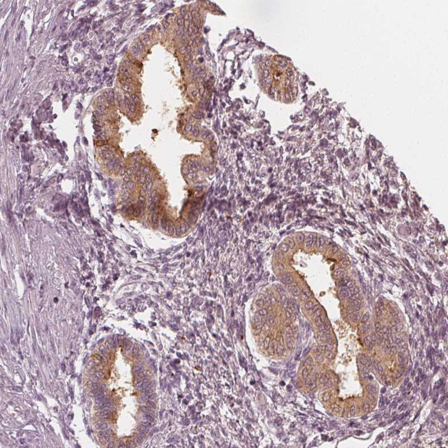 PAEP Antibody in Immunohistochemistry (IHC)