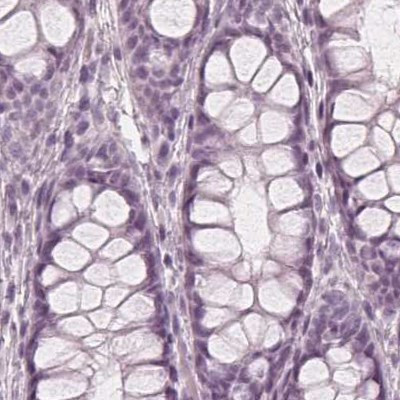 PAEP Antibody in Immunohistochemistry (IHC)