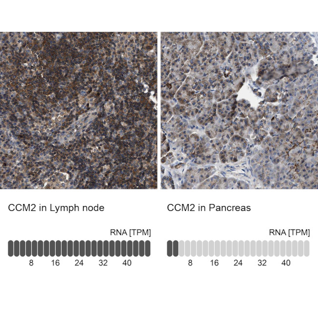 CCM2 Antibody in Immunohistochemistry (IHC)