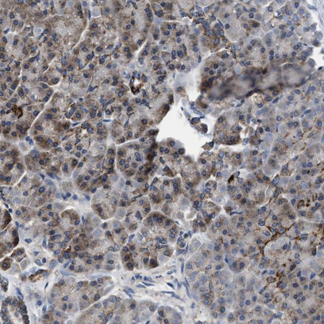 CCM2 Antibody in Immunohistochemistry (IHC)