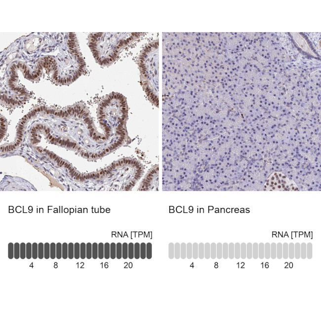 BCL9 Antibody in Immunohistochemistry (IHC)