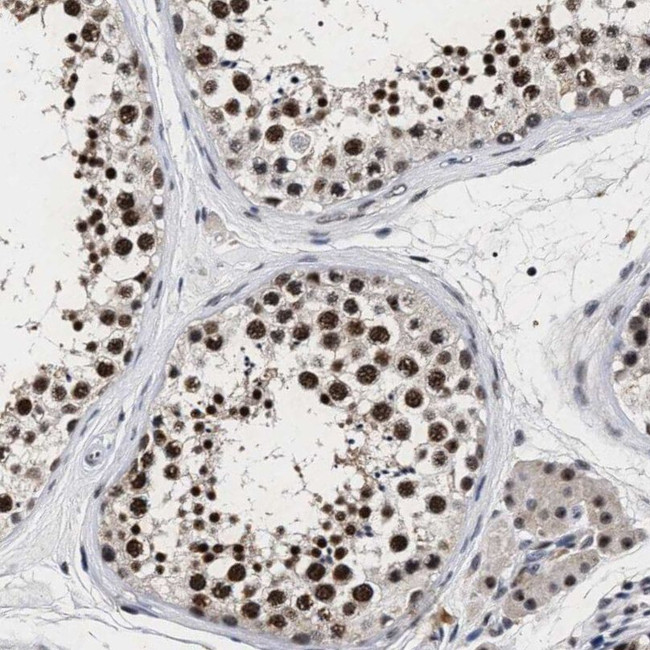 RRP1B Antibody in Immunohistochemistry (IHC)