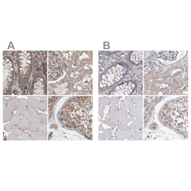 Ataxin 2 Antibody in Immunohistochemistry (IHC)