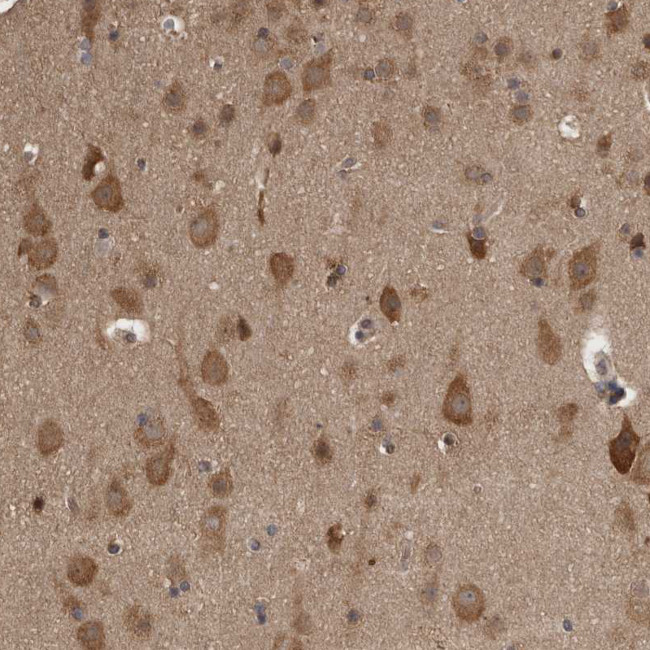 Ataxin 2 Antibody in Immunohistochemistry (IHC)