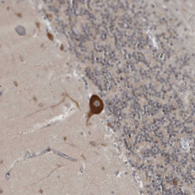 Ataxin 2 Antibody in Immunohistochemistry (IHC)