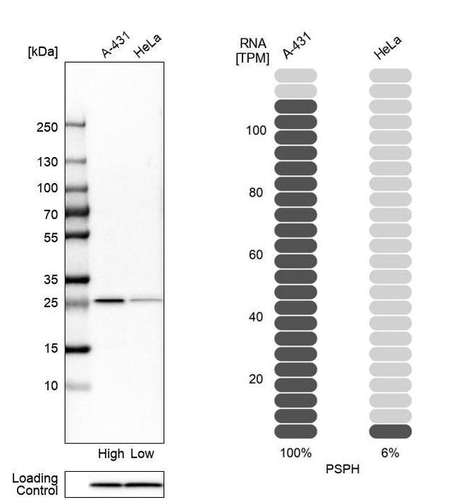 PSPH Antibody in Western Blot (WB)