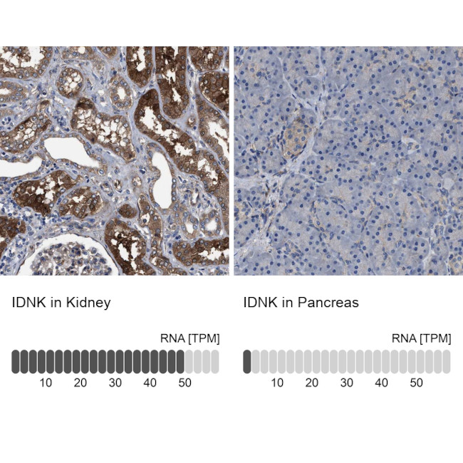 IDNK Antibody in Immunohistochemistry (IHC)