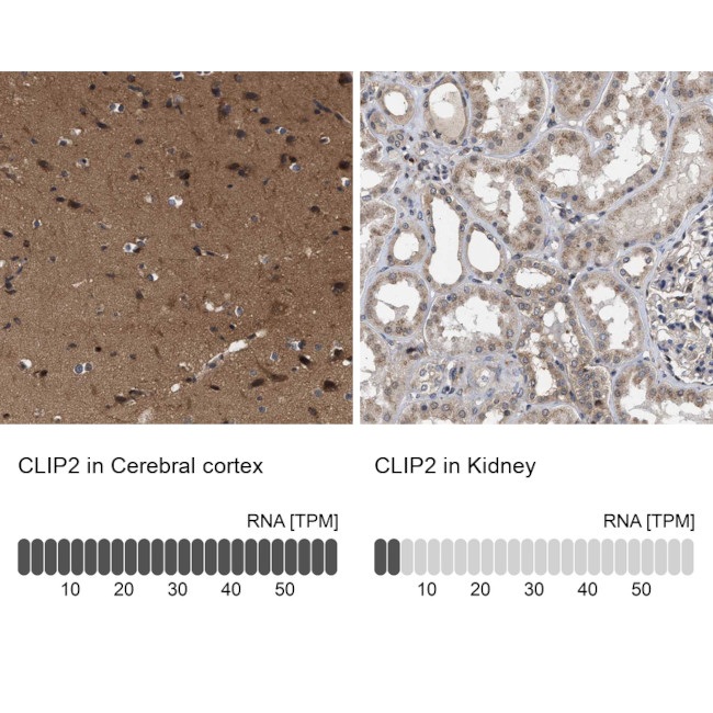 CLIP2 Antibody