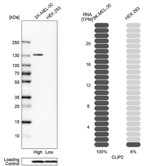 CLIP2 Antibody in Western Blot (WB)