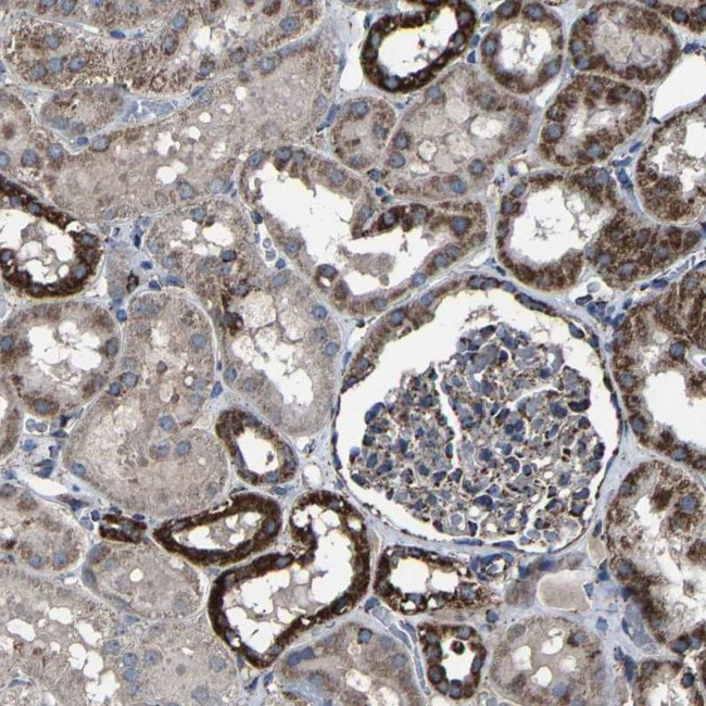 NDUFV3 Antibody in Immunohistochemistry (IHC)