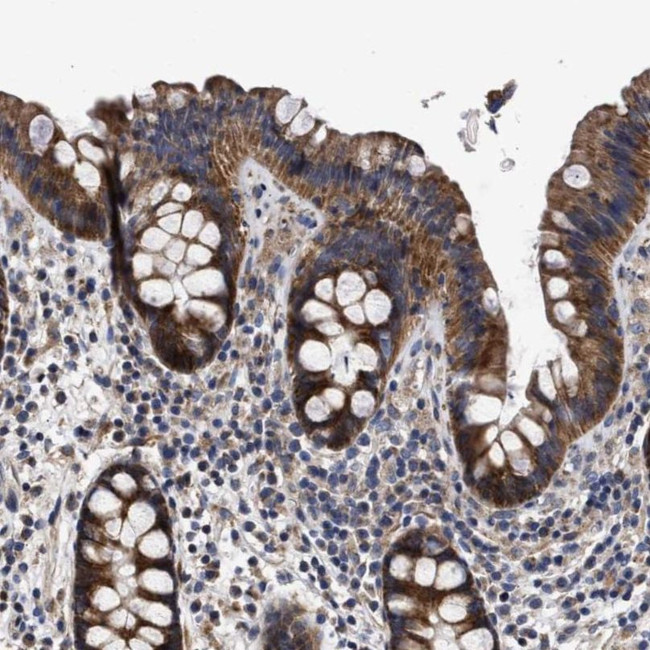 MALSU1 Antibody in Immunohistochemistry (IHC)