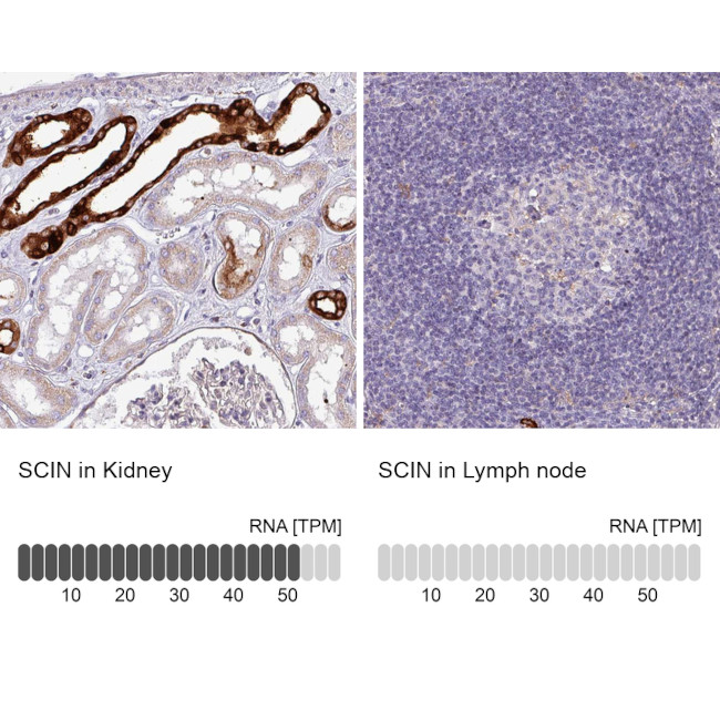 SCIN Antibody