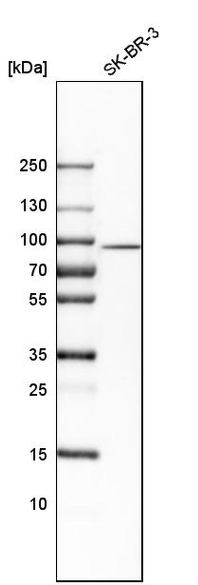 SCIN Antibody in Western Blot (WB)