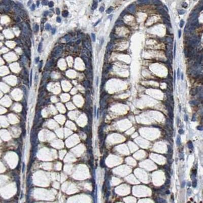 SHMT2 Antibody in Immunohistochemistry (IHC)