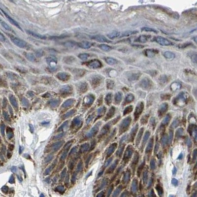 SHMT2 Antibody in Immunohistochemistry (IHC)