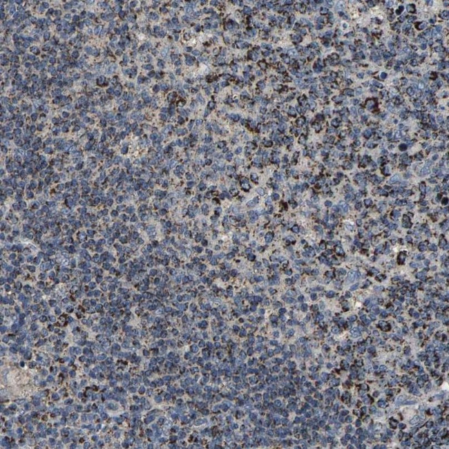 SHMT2 Antibody in Immunohistochemistry (IHC)