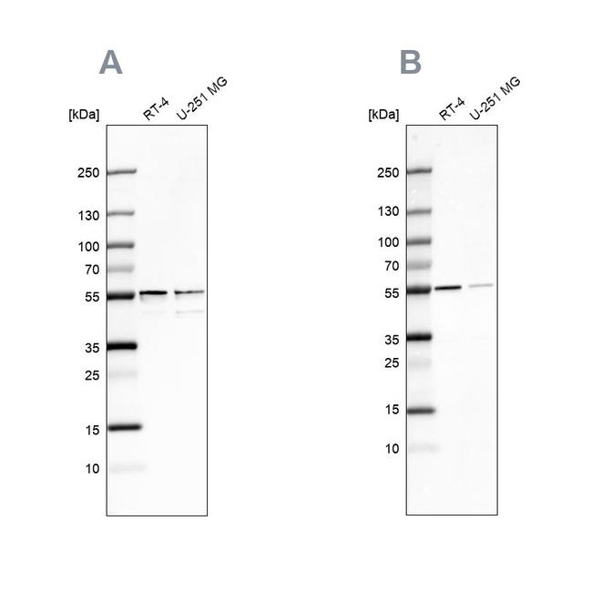 SHMT2 Antibody in Western Blot (WB)