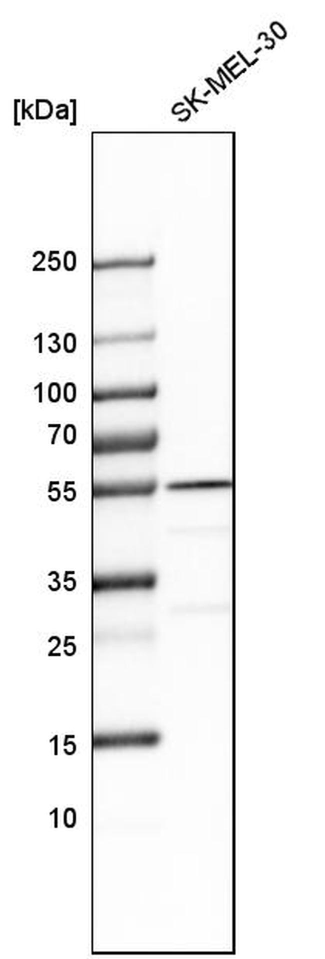 SHMT2 Antibody in Western Blot (WB)