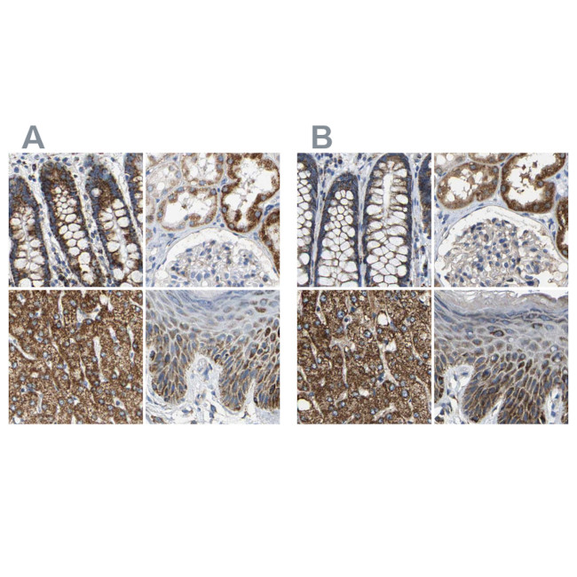 SHMT2 Antibody in Immunohistochemistry (IHC)