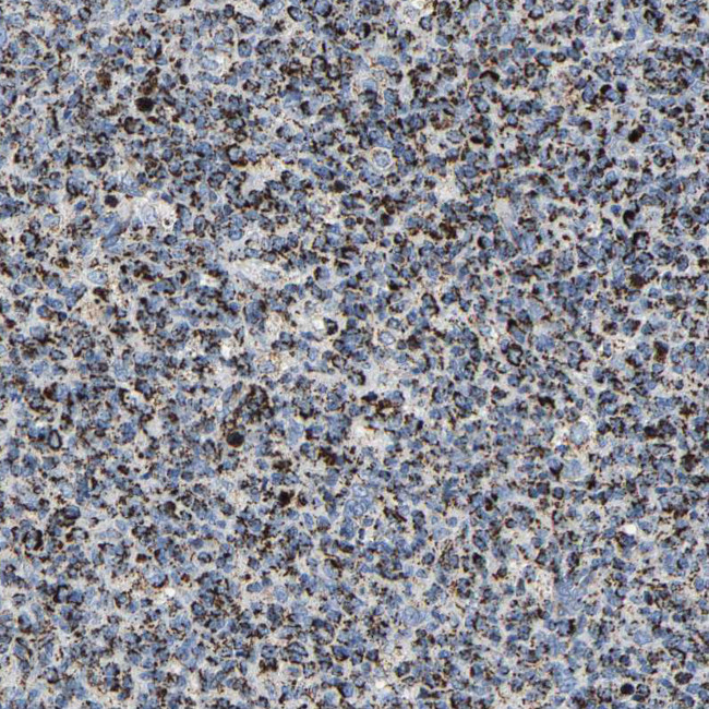 SHMT2 Antibody in Immunohistochemistry (IHC)