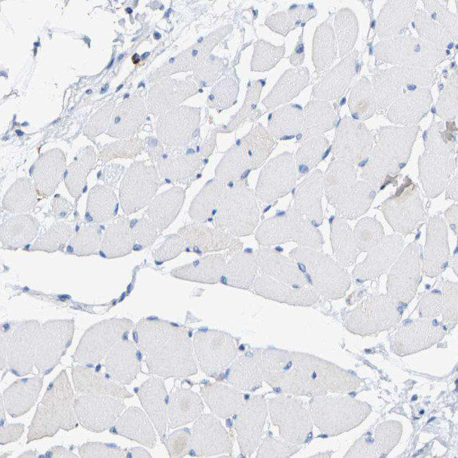 SHMT2 Antibody in Immunohistochemistry (IHC)