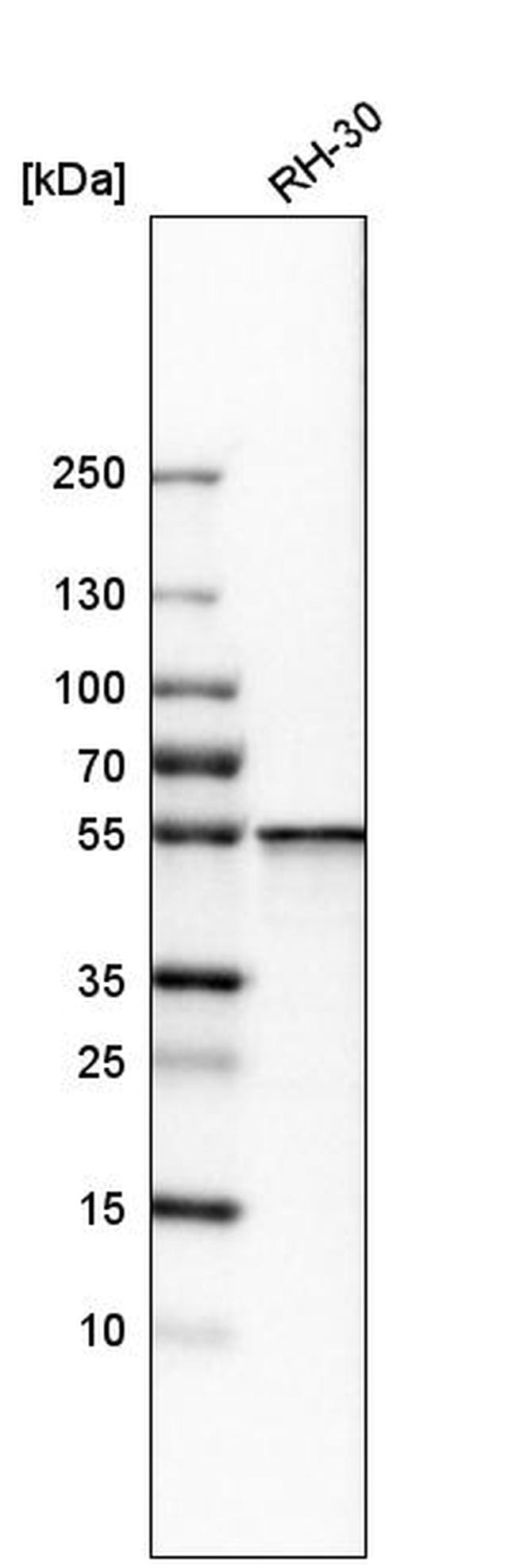 SHMT2 Antibody in Western Blot (WB)